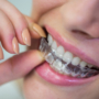What are Clear Aligners? A quick guide to understand how they can perfect your smile.