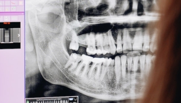 What’s the Difference Between a Holistic Dentist and a Regular Dentist?